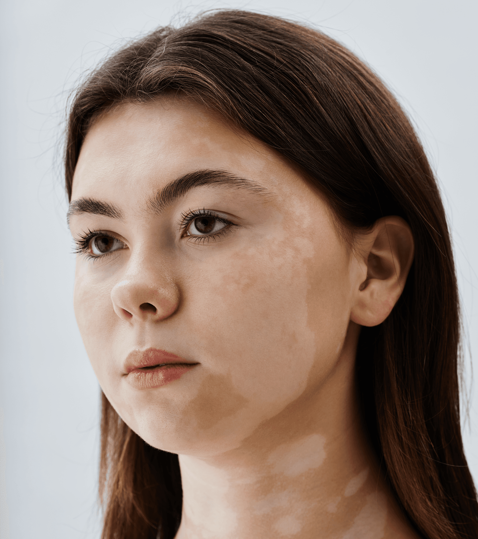 Dermatological Diseases