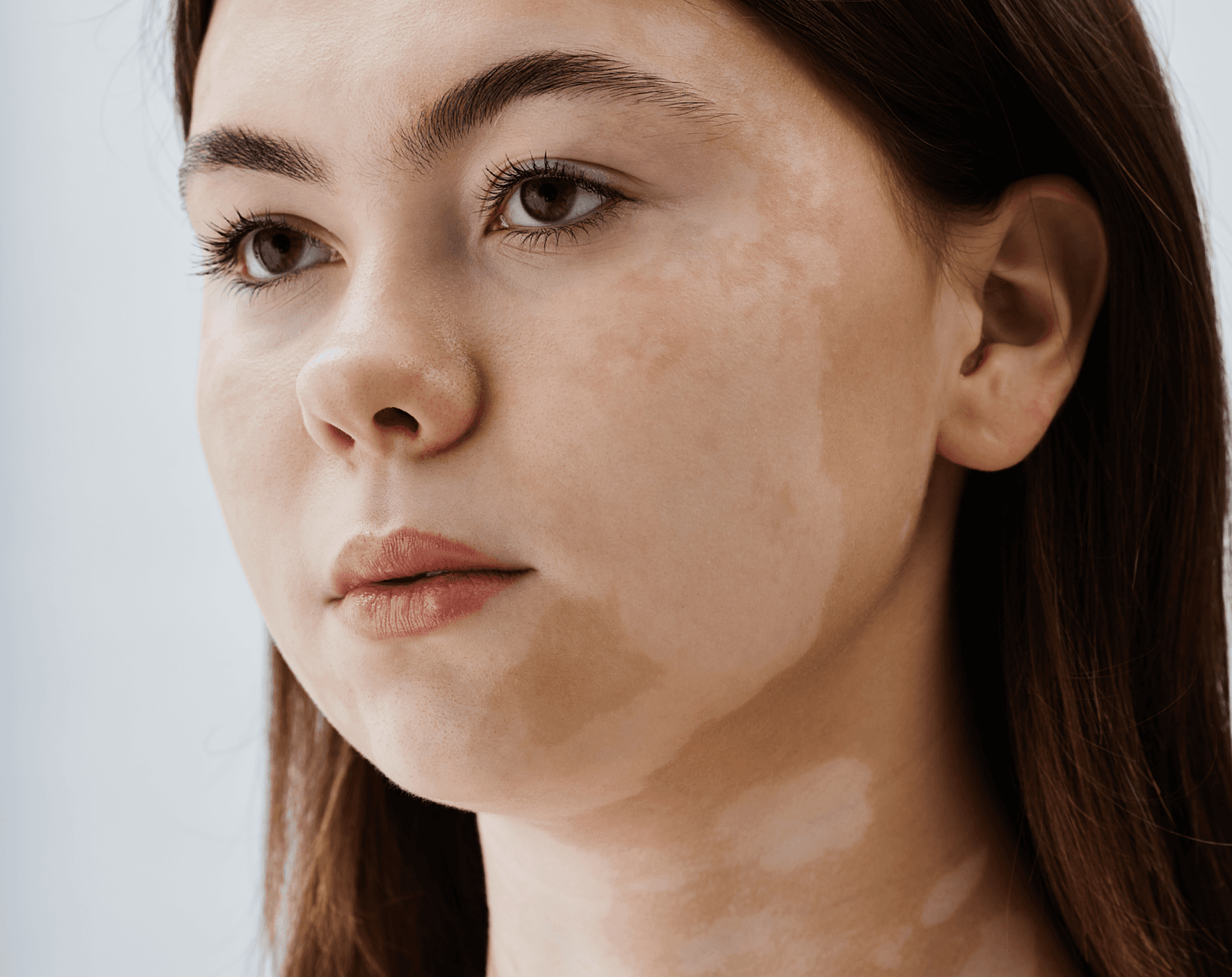 Dermatological Diseases